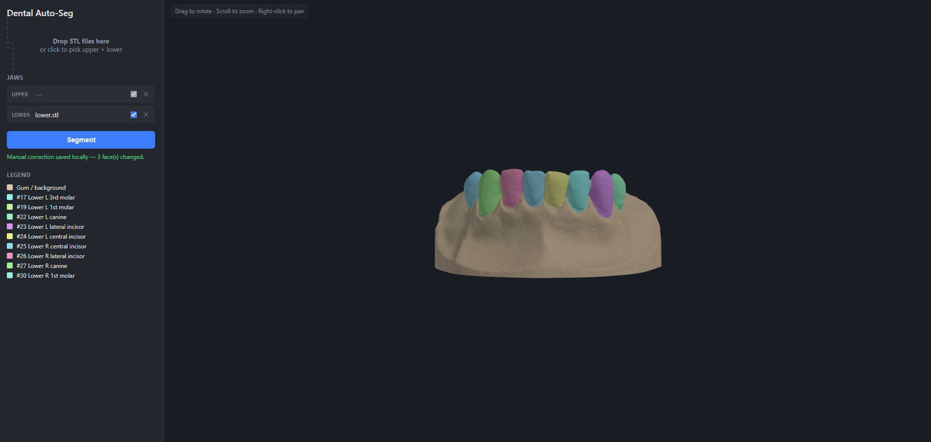 Dental scan separated into colored tooth regions