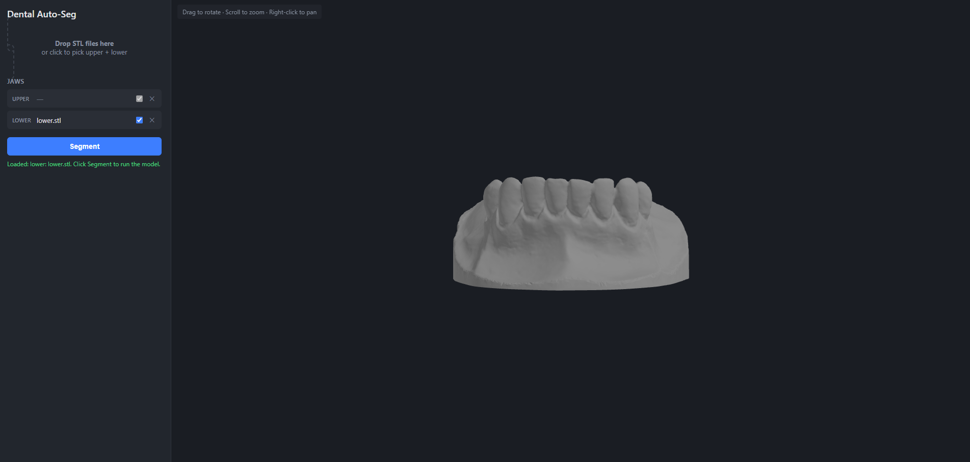 Unsegmented lower dental scan